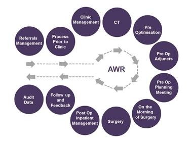 The 12 step process for Abdominal Wall Resconstruction