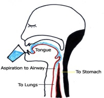 Dysphagia icon